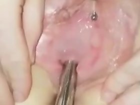 Uretrale Armlet Doppia Penetrazione